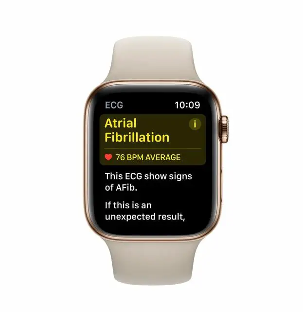 ECG Alerts on Apple Watch smartwatch