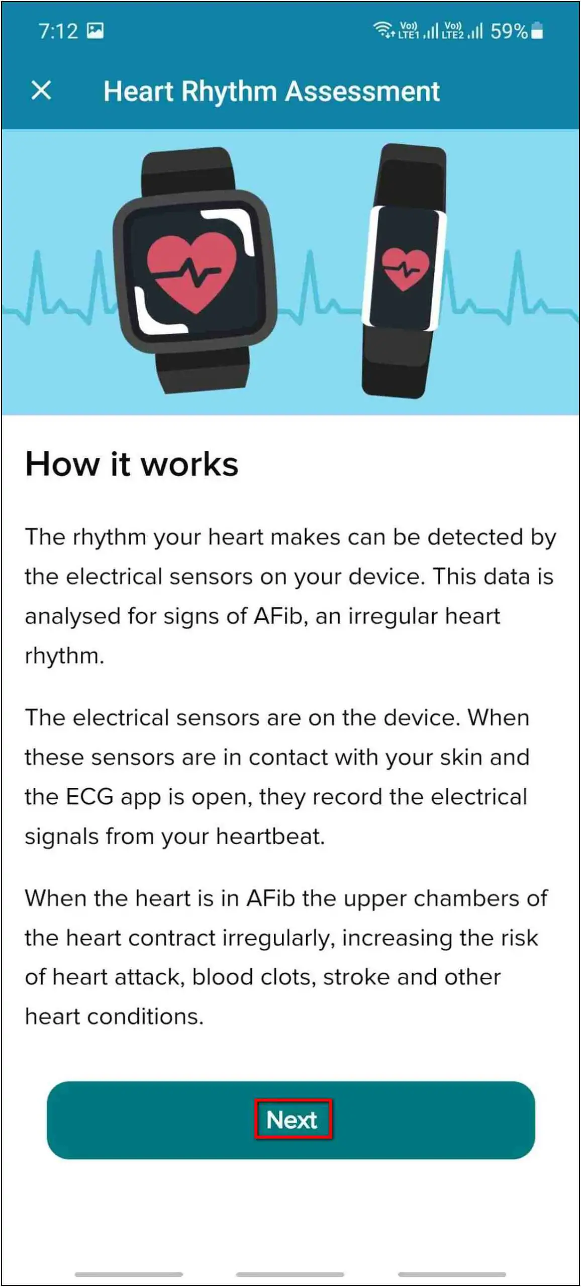 Setup ECG on Fitbit Charge 5